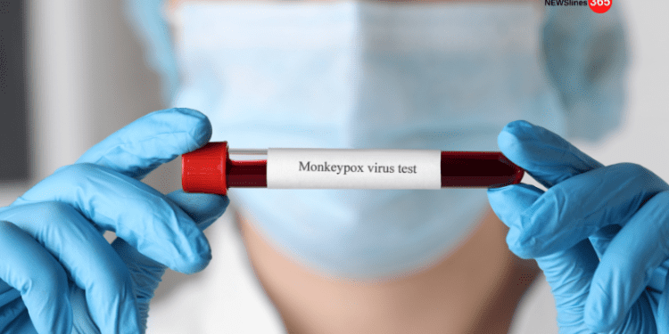 US-FDA new COVID-19 vaccination guidelines for kids WHO has re-named “monkeypox” with “mpox”